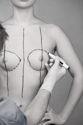 BREAST FAT TRANSFER